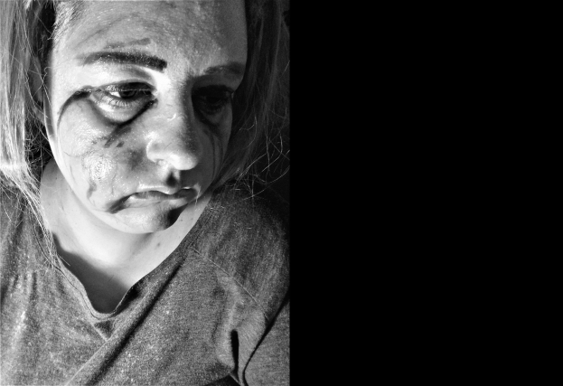 Schwarz-weiß-Foto einer Frau mit Gesichtsverletzungen, ernster Gesichtsausdruck, konzentrierter Blick, zurückgebundenes Haar, trägt ein T-Shirt.